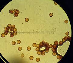 Attēlu rezultāti vaicājumam “Metatrichia vesparia”