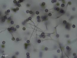 Attēlu rezultāti vaicājumam “Lamproderma puncticulatum spores”