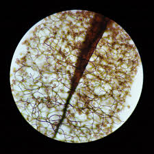 Attēlu rezultāti vaicājumam “Comatricha laxa young”