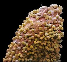 Attēlu rezultāti vaicājumam “Diachea leucopodia spores”