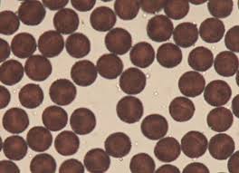 Attēlu rezultāti vaicājumam “Badhamia lilacina var. megaspora spores”