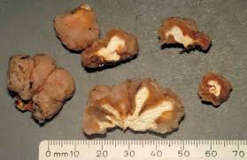 Attēlu rezultāti vaicājumam “Tremella encephala”