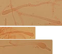 Attēlu rezultāti vaicājumam “Phlebia rufa”