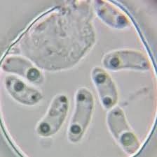 Attēlu rezultāti vaicājumam “Cinereomyces lindbladii”