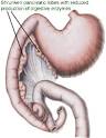 Exocrine Pancreatic Insufficiency