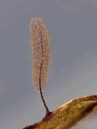 Attēlu rezultāti vaicājumam “Stemonitopsis aequalis var. microspora spores”