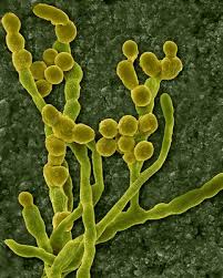 Attēlu rezultāti vaicājumam “Coleosporium sp.”