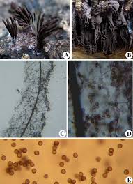 Attēlu rezultāti vaicājumam “Diderma cingulatum spores”