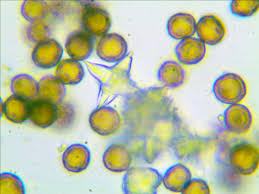 Attēlu rezultāti vaicājumam “Didymium minus macro”