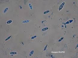 Attēlu rezultāti vaicājumam “Cliostomum corrugatum”