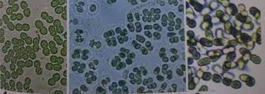 Attēlu rezultāti vaicājumam “Gloeocapsa rupestris”