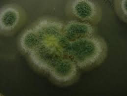 Attēlu rezultāti vaicājumam “Badhamia versicolor spores”