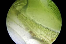 Attēlu rezultāti vaicājumam “Philonotis marchica macro”