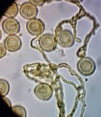 Attēlu rezultāti vaicājumam “Licea chelonoides spores”