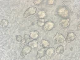 Attēlu rezultāti vaicājumam “Physisporinus vitreus”