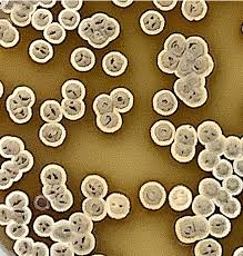 Attēlu rezultāti vaicājumam “Arcyria imperialis stalked”