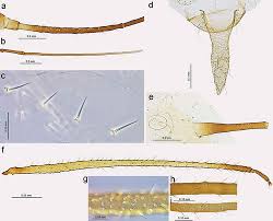 Attēlu rezultāti vaicājumam “Macrosiphoniella absinthii”