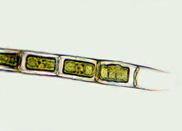 Attēlu rezultāti vaicājumam “Comatricha elegans var. microspora”