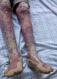 Image result for Lewandowsky-Lutz