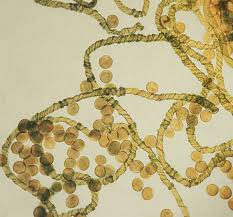 Attēlu rezultāti vaicājumam “Hemitrichia sordivesiculosa”