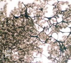 Attēlu rezultāti vaicājumam “Diderma chondrioderma sessile”