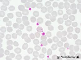 Attēlu rezultāti vaicājumam “Diderma cingulatum plasmodium”