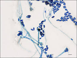 Attēlu rezultāti vaicājumam “Badhamiopsis macrospora spores”