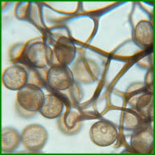Attēlu rezultāti vaicājumam “Comatricha ellae spores”