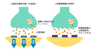 Image result for 向精神薬副作用