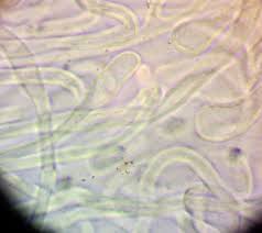 Attēlu rezultāti vaicājumam “Lycogala persicum sessile”