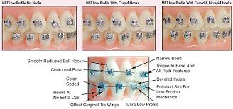 Image result for low-profile bracket