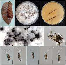 Attēlu rezultāti vaicājumam “Tubifera applanata spores”