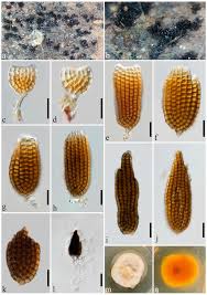 Attēlu rezultāti vaicājumam “Diachea dictyospora (syn. Craterium dictyosporum) spores”