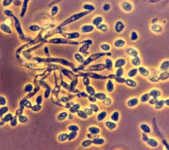 Attēlu rezultāti vaicājumam “Orbilia sp.”