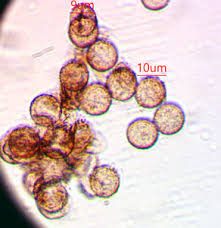 Attēlu rezultāti vaicājumam “Physarum braunianum plasmodium”