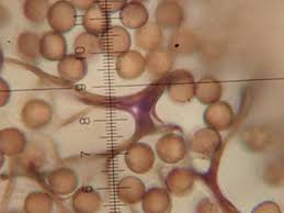 Attēlu rezultāti vaicājumam “Stemonitopsis aequalis var. microspora spores”