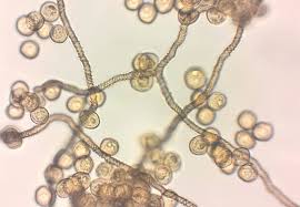 Attēlu rezultāti vaicājumam “Trichia contorta”