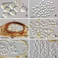 Attēlu rezultāti vaicājumam “Pucciniastrum areolatum”