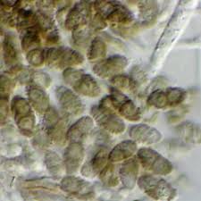 Attēlu rezultāti vaicājumam “Calicium salicinum”