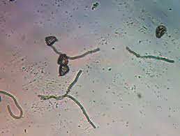 Attēlu rezultāti vaicājumam “Diderma ochraceum young”