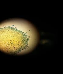 Attēlu rezultāti vaicājumam “Coleosporium sp.”