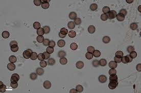 Attēlu rezultāti vaicājumam “Badhamiopsis sp.”