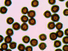 Attēlu rezultāti vaicājumam “Badhamia capsulifera var. arborea spores”