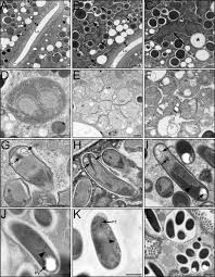 Attēlu rezultāti vaicājumam “Comatricha elegans var. microspora spores”