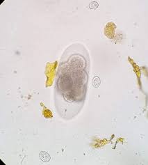 Image result for cestoda excrement dog