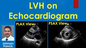 Image result for  ^ L V [ h    