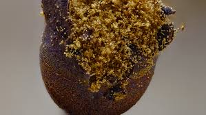 Attēlu rezultāti vaicājumam “Trichia botrytis var. cerifera spores”