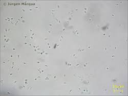 Attēlu rezultāti vaicājumam “Ceriporia viridans”