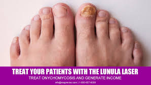 Image result for lunula nail