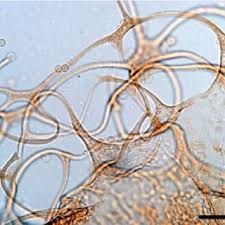 Attēlu rezultāti vaicājumam “Badhamia capsulifera”